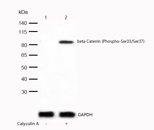 beta Catenin (Phospho-Ser33/Ser37) Rabbit mAb