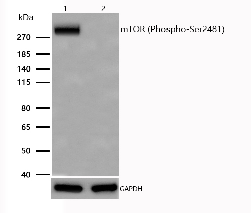 mTOR (Phospho-Ser2481) Rabbit mAb