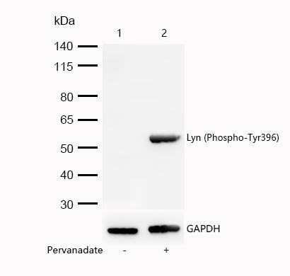 Lyn (Phospho-Tyr396) Rabbit mAb