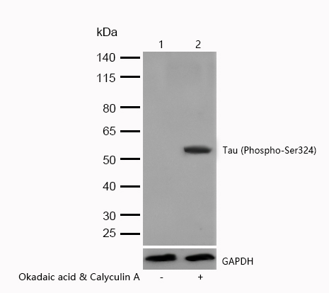 Tau (Phospho-Ser324) Rabbit mAb