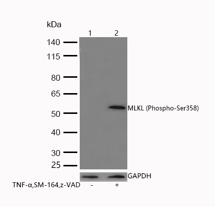 MLKL (Phospho-Ser358) Rabbit mAb