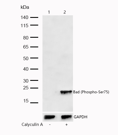 Bad (Phospho-Ser75) Rabbit mAb