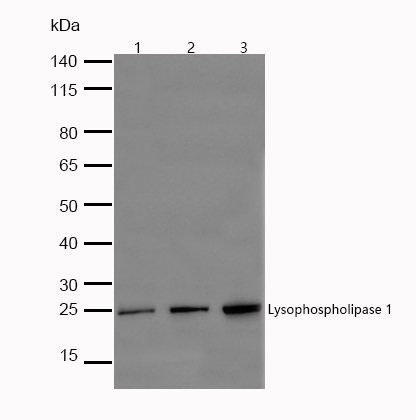 Lysophospholipase 1 Rabbit mAb