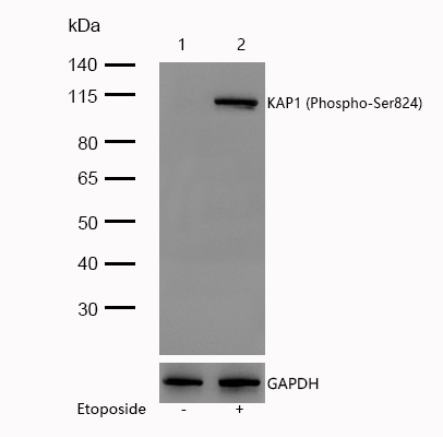 KAP1 (Phospho-Ser824) Rabbit mAb
