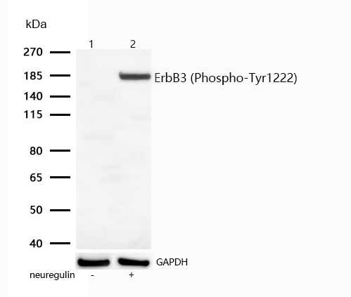 ErbB3 (Phospho-Tyr1222) Rabbit mAb