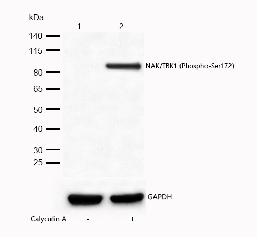 NAK/TBK1 (Phospho-Ser172) Rabbit mAb