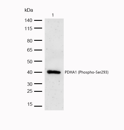 PDHA1 (Phospho-Ser293) Rabbit mAb