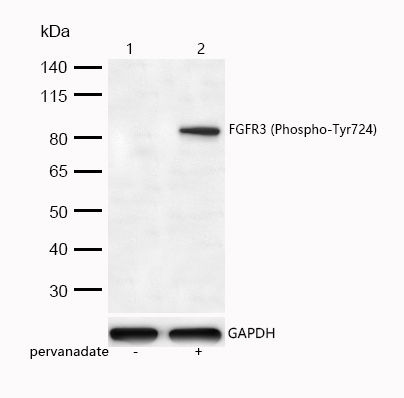 FGFR3 (Phospho-Tyr724) Rabbit mAb