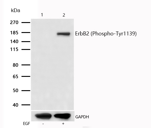 ErbB2 (Phospho-Tyr1139) Rabbit mAb
