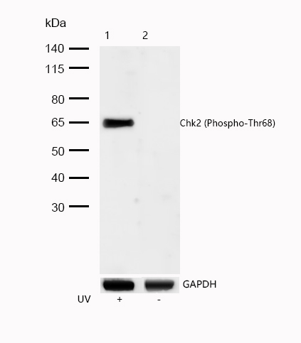 Chk2 (Phospho-Thr68) Rabbit mAb
