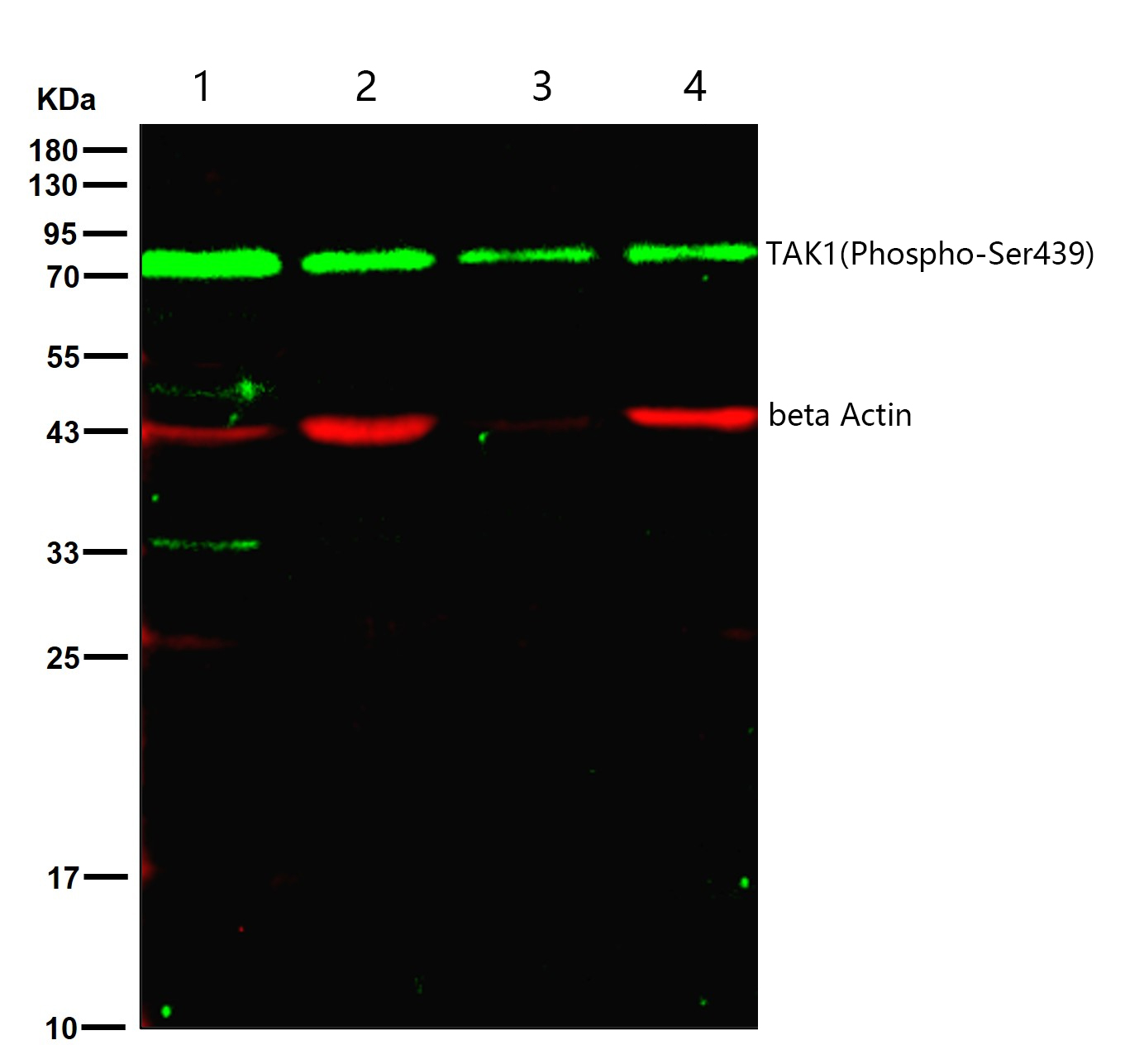 TAK1(Phospho-Ser439) Rabbit mAb