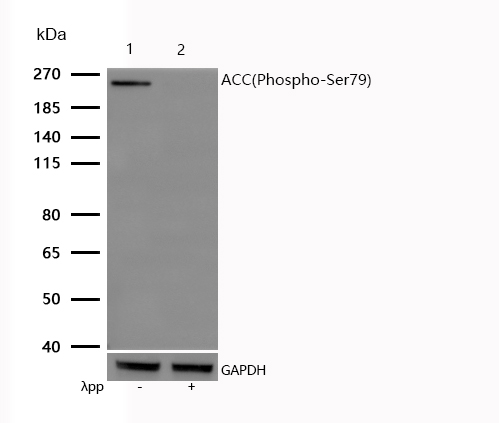 ACC(Phospho-Ser79) Rabbit mAb