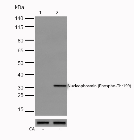 Nucleophosmin (Phospho-Thr199) Rabbit mAb