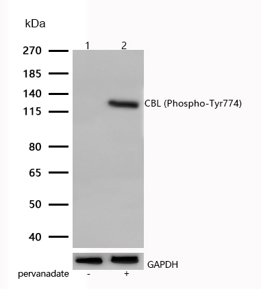 CBL (Phospho-Tyr774) Rabbit mAb