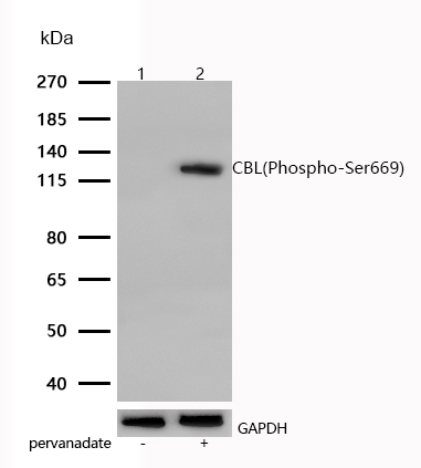 CBL(Phospho-Ser669) Rabbit mAb