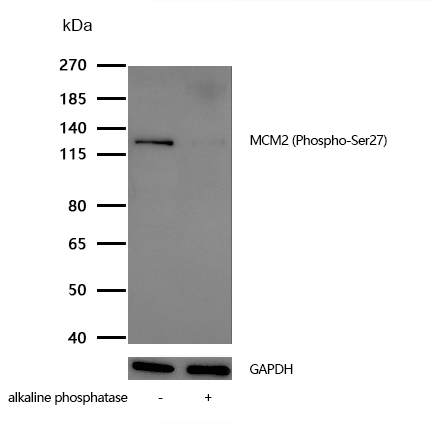 MCM2 (Phospho-Ser27) Rabbit mAb