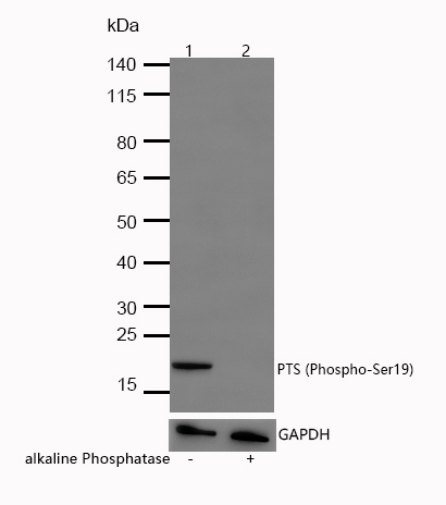 PTS (Phospho-Ser19) Rabbit mAb