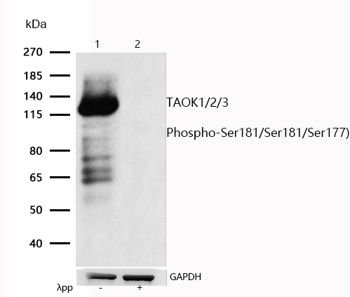 TAOK1/2/3 (Phospho-Ser181/Ser181/Ser177) Rabbit mAb