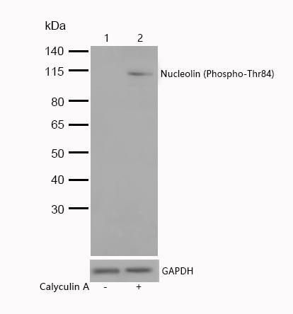Nucleolin (Phospho-Thr84) Rabbit mAb