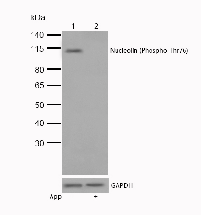 Nucleolin (Phospho-Thr76) Rabbit mAb