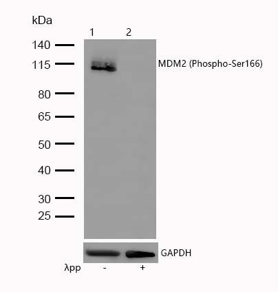 MDM2 (Phospho-Ser166) Rabbit mAb
