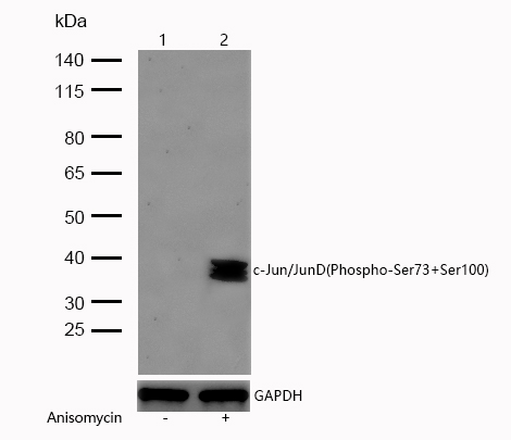 c-Jun/JunD(Phospho-Ser73+Ser100) Rabbit mAb