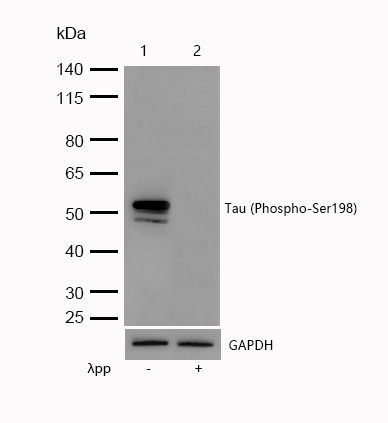 Tau (Phospho-Ser198) Rabbit mAb