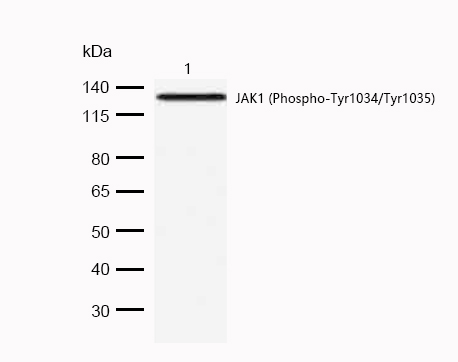 JAK1 (Phospho-Tyr1034/Tyr1035) Rabbit mAb