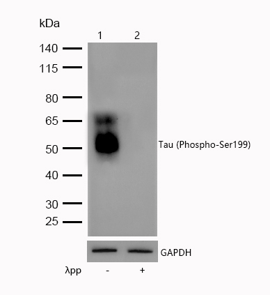 Tau (Phospho-Ser199) Rabbit mAb