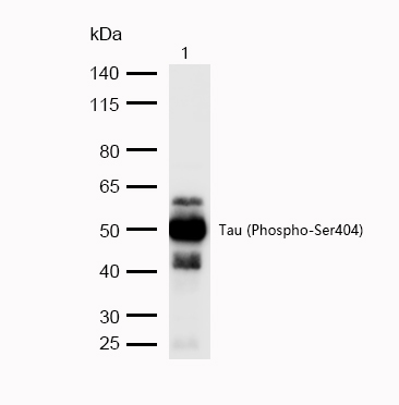 Tau (Phospho-Ser404) Rabbit mAb