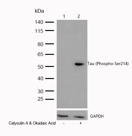 Tau (Phospho-Ser214) Rabbit mAb