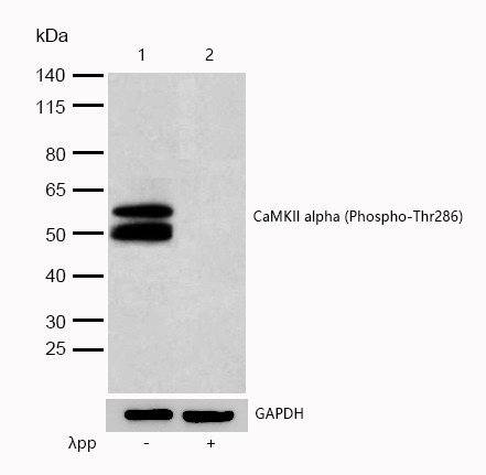 CaMKII alpha (Phospho-Thr286) Rabbit mAb
