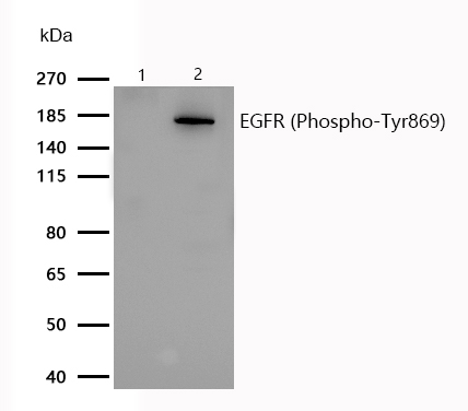EGFR (Phospho-Tyr869) Rabbit mAb