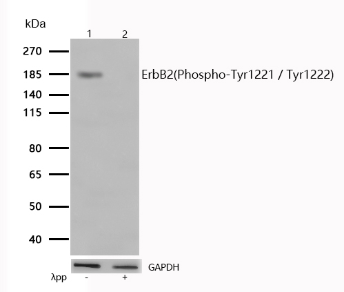 ErbB2(Phospho-Tyr1221 / Tyr1222) Rabbit mA
