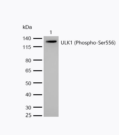 ULK1 (Phospho-Ser556) Rabbit mAb