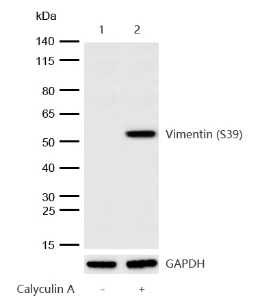 Vimentin (Phospho-S39) Rabbit mAb
