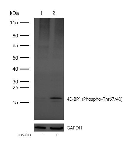 4E-BP1 (Phospho-Thr37/46) Rabbit mAb