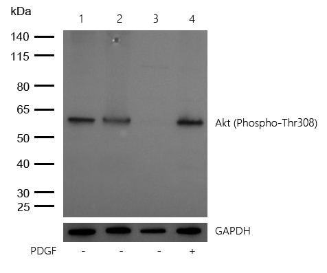 Akt (Phospho-Thr308) Rabbit mAb