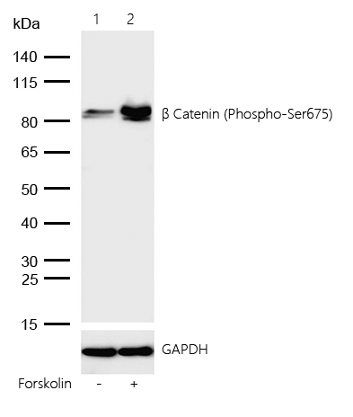 β Catenin (Phospho-Ser675) Rabbit mAb