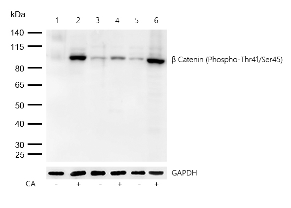 β Catenin (Phospho-Thr41/Ser45) Rabbit mAb