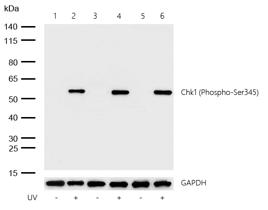 Chk1 (Phospho-Ser345) Rabbit mAb