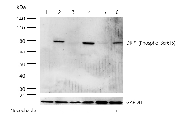 DRP1 (Phospho-Ser616) Rabbit mAb