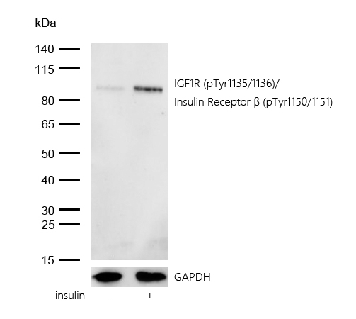 IGF1R (Phospho-Tyr1135/1136)/Insulin Receptor β (Phospho-Tyr1150/1151) Rabbit mAb