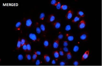 MSK1 (Phospho-Ser360) Rabbit mAb