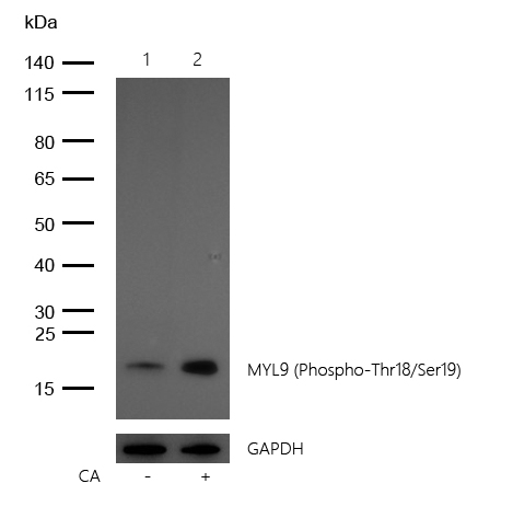 MYL9 (Phospho-Thr18/Ser19) Rabbit mAb