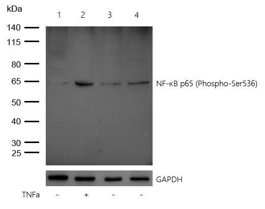 NF-κB p65 (Phospho-Ser536) Rabbit mAb