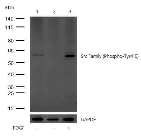 Src Family (Phospho-Tyr416) Rabbit mAb