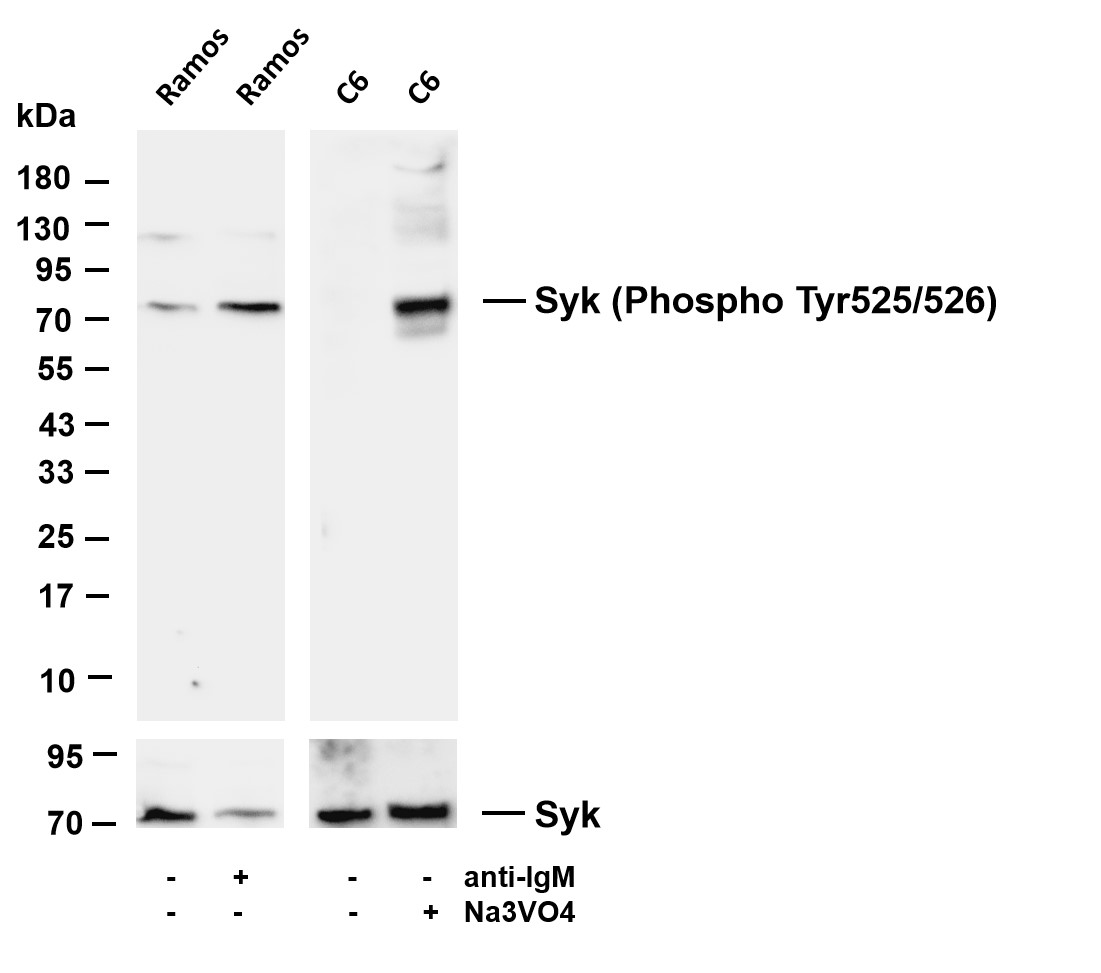 Syk (Phospho-Tyr525/526) Rabbit mAb