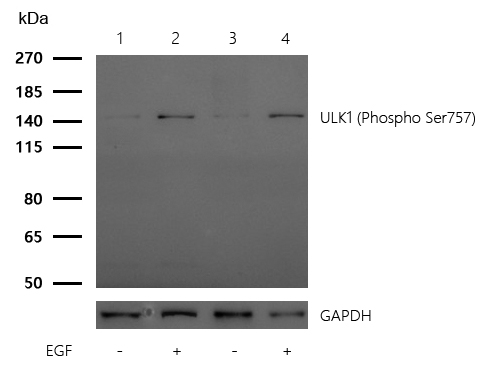 ULK1 (Phospho-Ser757) Rabbit mAb