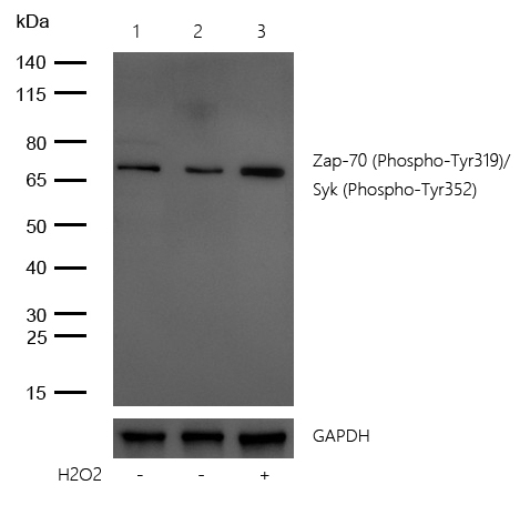Zap-70 (Phospho-Tyr319)/Syk (Phospho-Tyr352) Rabbit mAb
